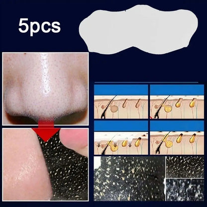 5-100PC Nose Blackhead Remover Strip Deep Cleansing Shrink Pore Acne Treatment Mask Black Dots Pore Strips Face Skin Care Patch